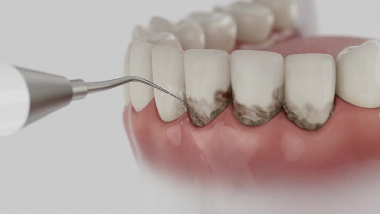 Trusted Teeth Cleaning And Checkup service in Canal Winchester, OH - Dentist Open Now